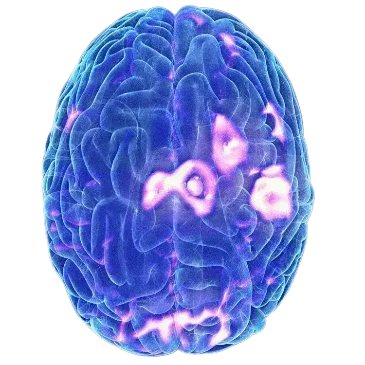 Before TMS Treatment at MD TruCare